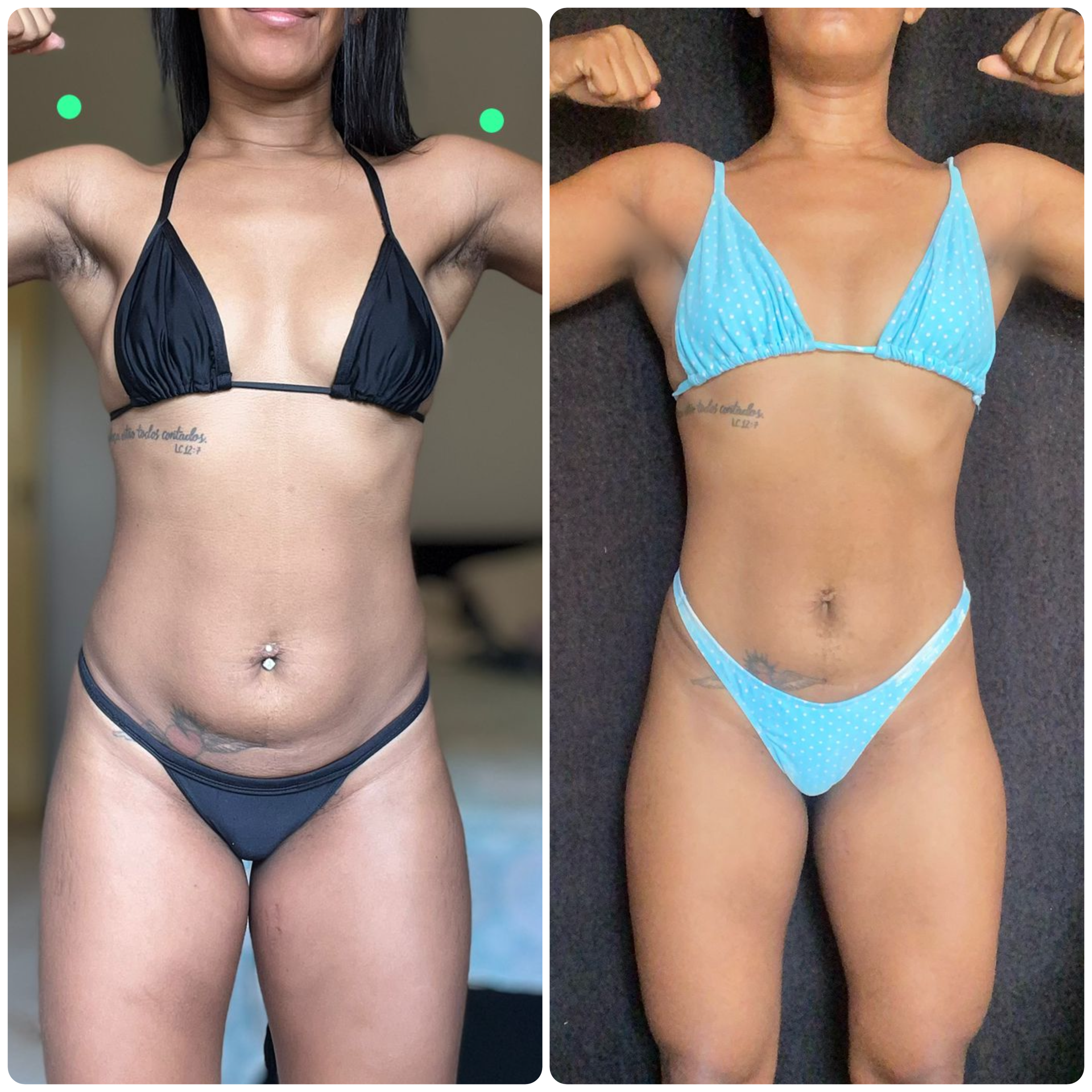 Antes e depois 4